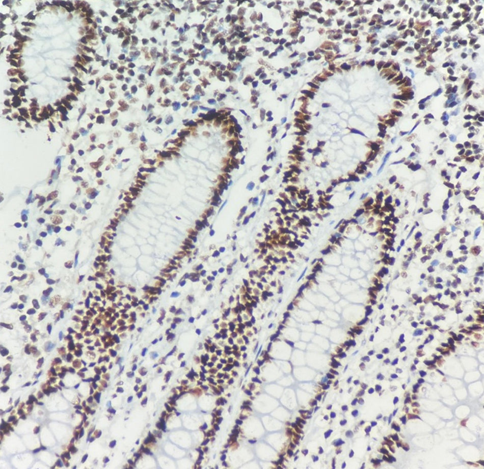 MSH2 (DA083)