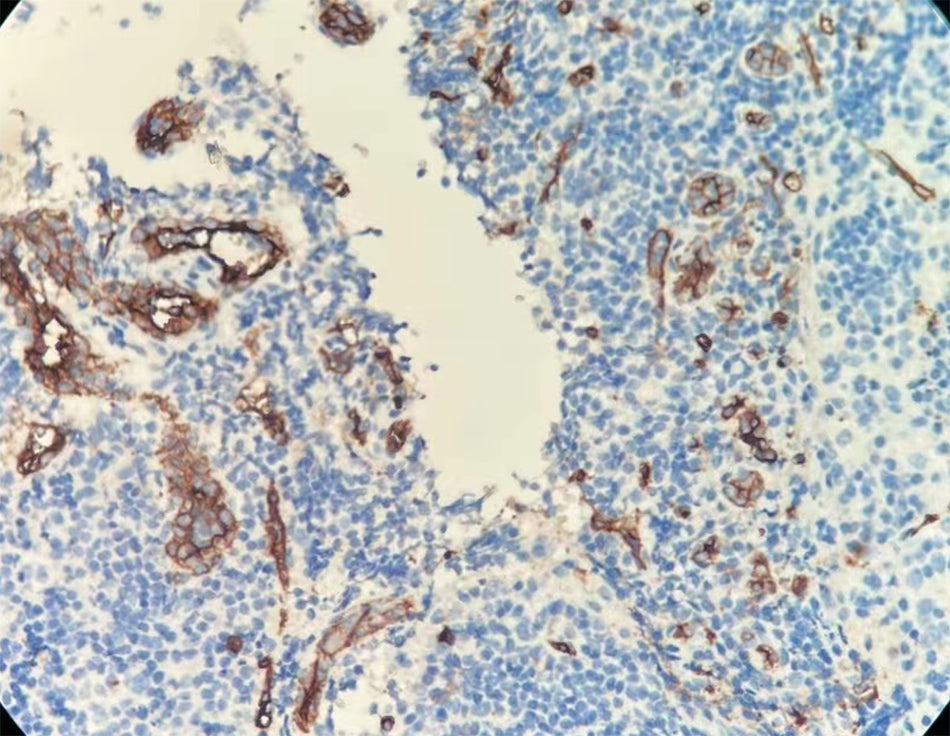 CD34 (DA022)