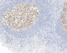 Charger l'image dans la galerie, Bcl-6 (DA005)
