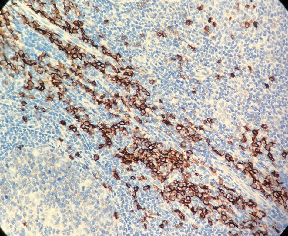 CD38 (DA023)