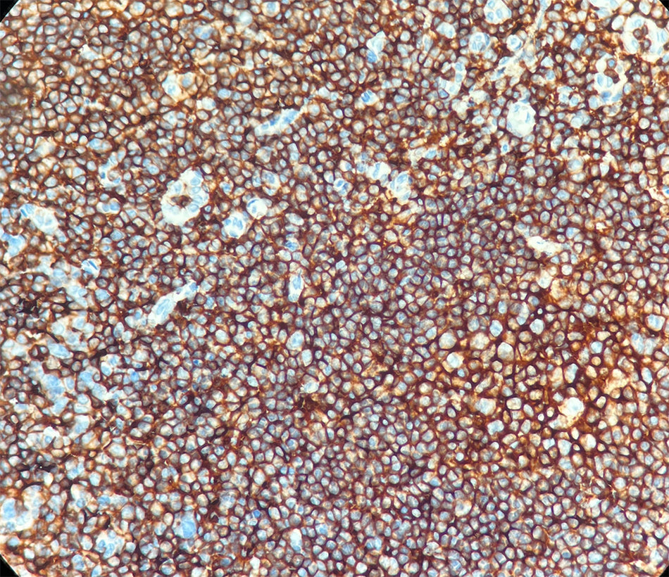 CD45 (DA026)