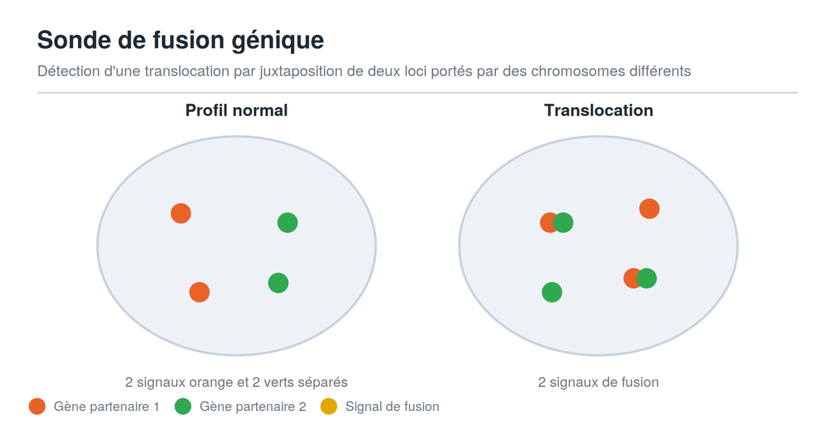 Schéma des signaux d'une sonde FISH de fusion génique