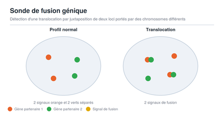 Schéma des signaux d'une sonde FISH de fusion génique