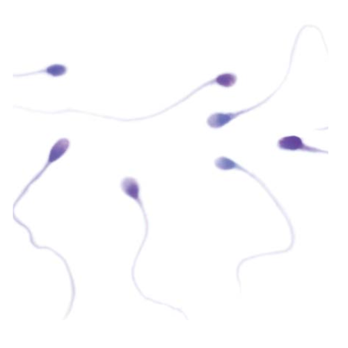 Kit Sperm-Diff RTU